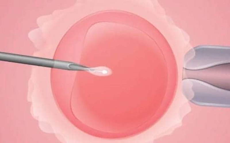解读最新试管婴儿技术——咨询热点问题一览